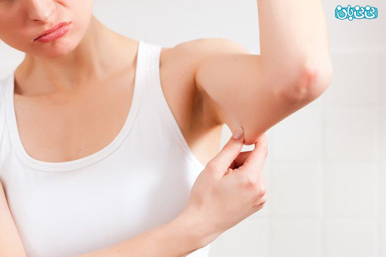درباره درمان سلولیت ران و بازو و شکم با اندولیفت چه می‌دانید؟