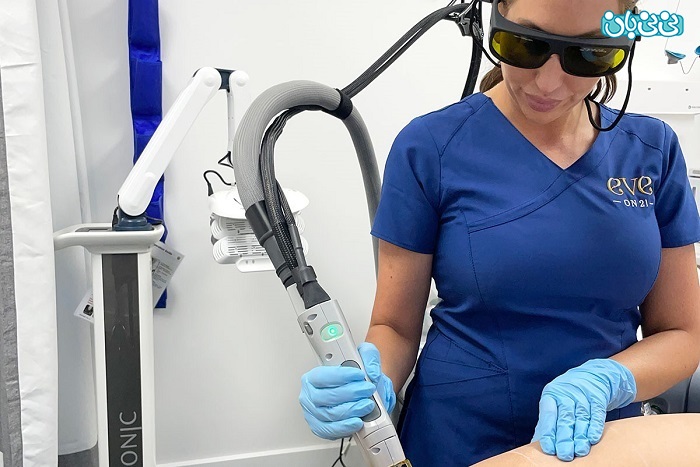 لیزر کندلای 2022، پیشرفته‌ترین دستگاه لیزر برای درمان موهای زائد