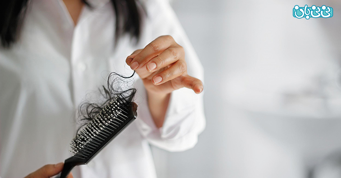 ریزش موی ناشی از کرونا، چه درمانی دارد؟