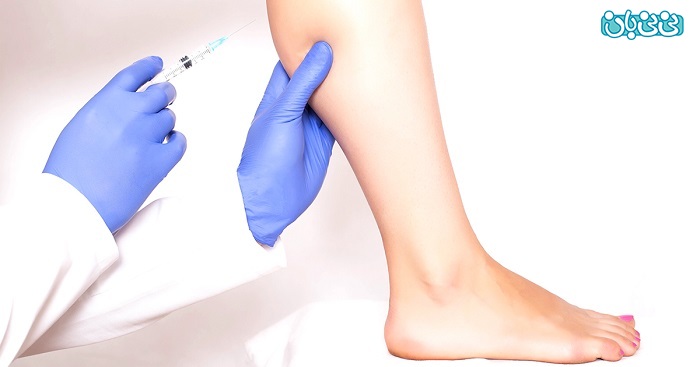 جراحی لاغری پا، معرفی سه راه موثر برای لاغر کردن پاها