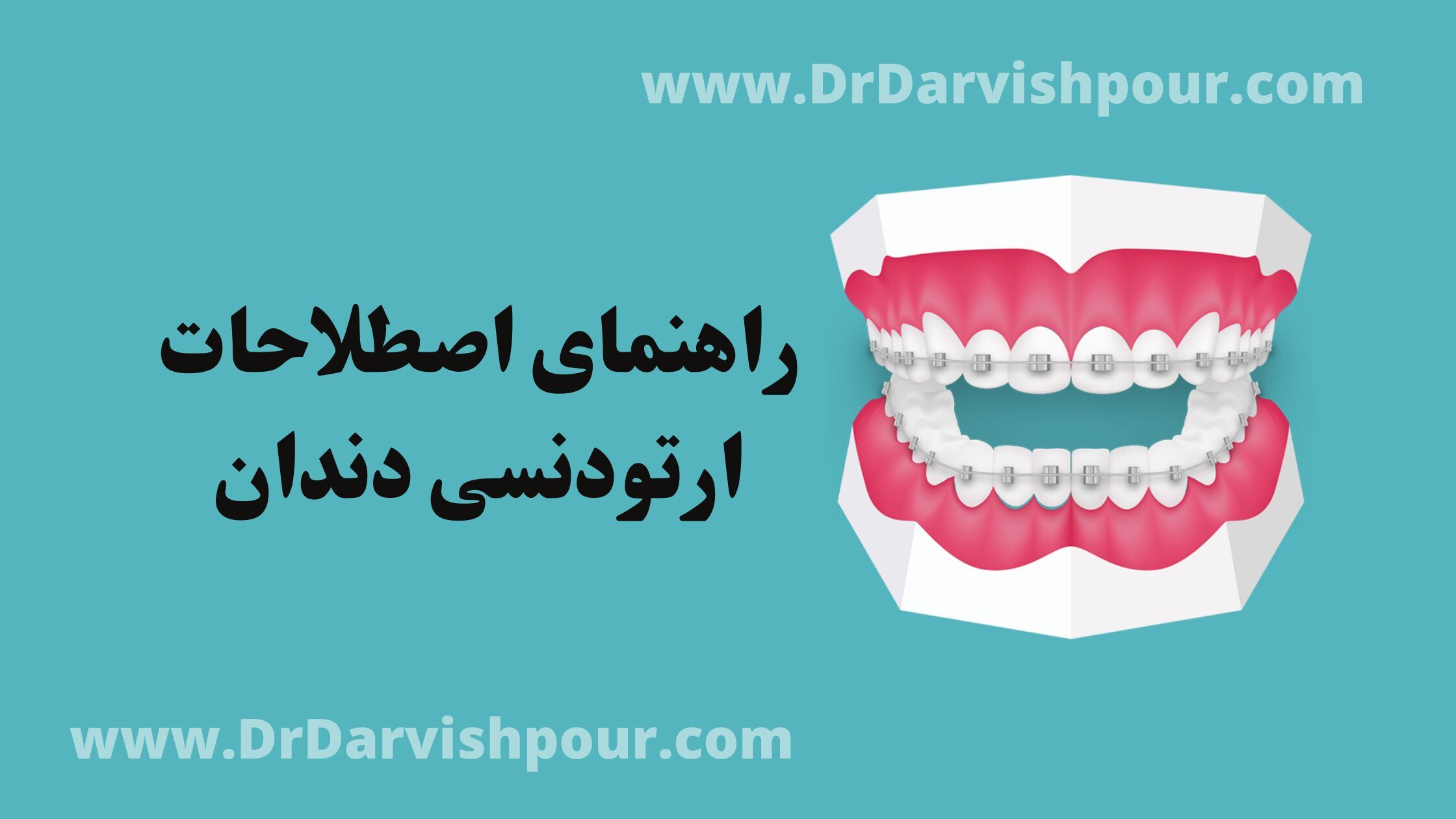 آیا با اصطلاحات ارتودنسی دندان آشنا هستید؟
