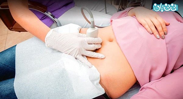 بهترین روش درمان تنبلی تخمدان