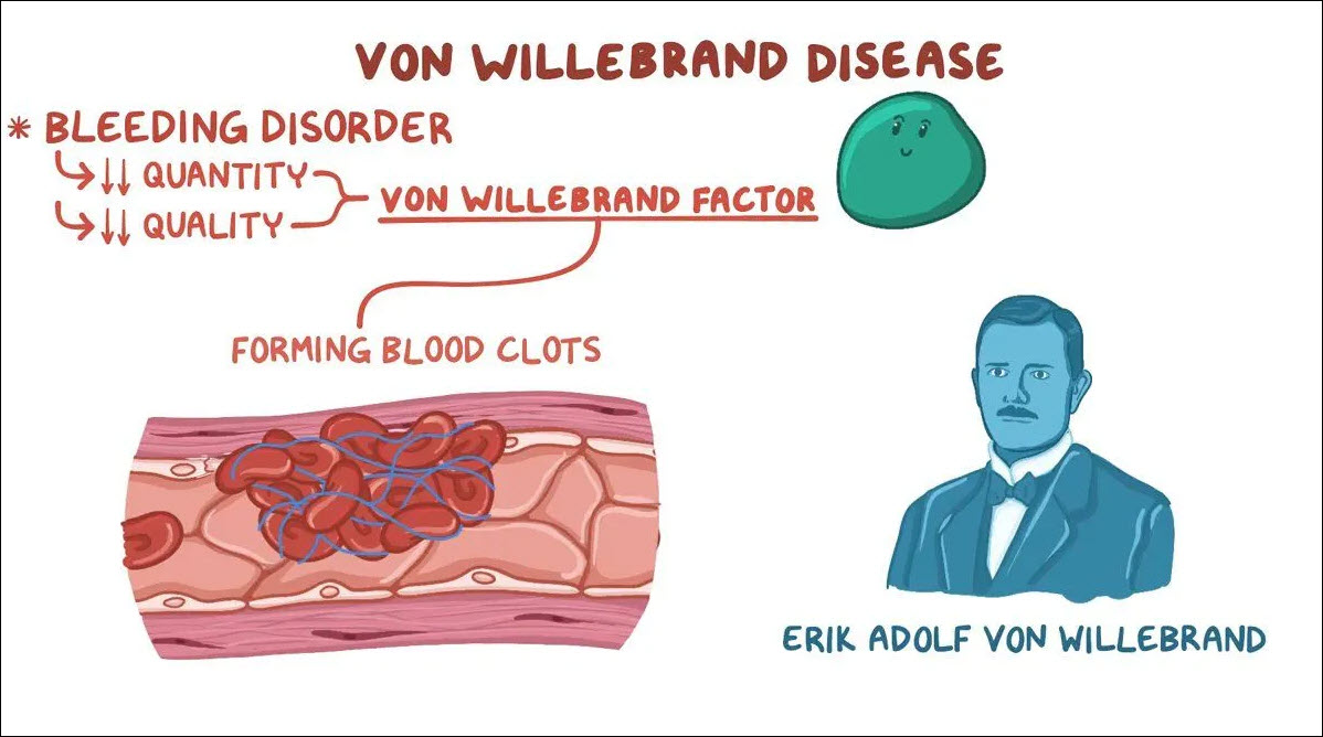 بیماری فون ویلبراند چیست – راه‌های تشخیص و درمان آن