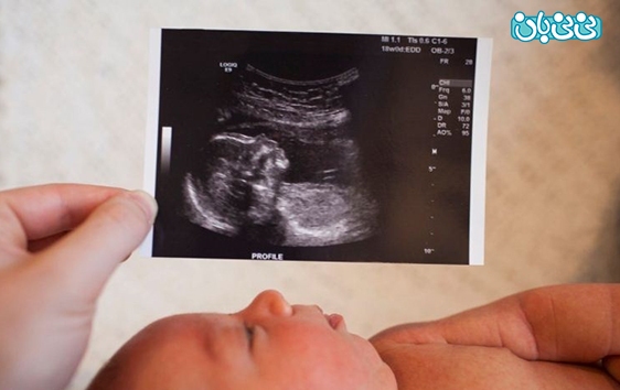 کاربرد سونوگرافی در تعیین جنسیت نوزاد