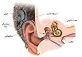 درمان رایگان کاشت حلزون شنوایی در سنین طلایی